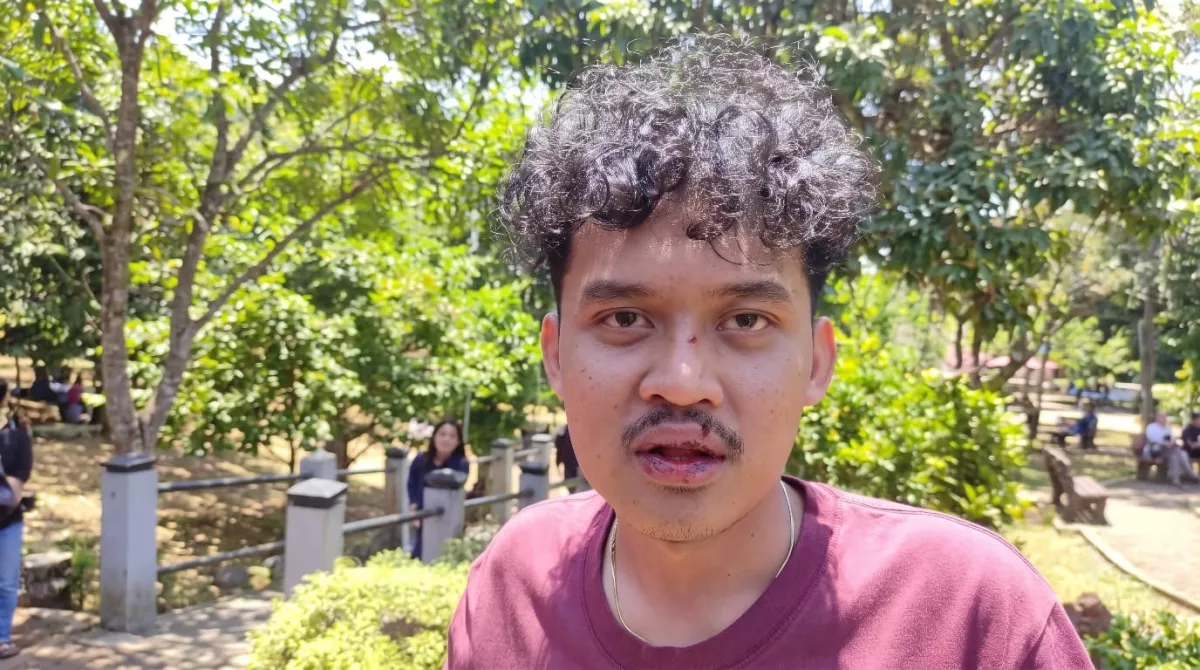 Demi Muluskan Jagoan Elit, Ketua GMNI Jember Babak Belur Dianiaya Pakai Batu di Arena Konferda